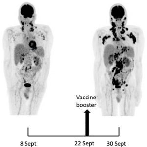 mRNA Vaccine Cause Cancer
