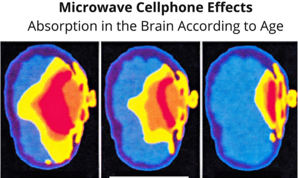 5g same frequency as DNA signalling