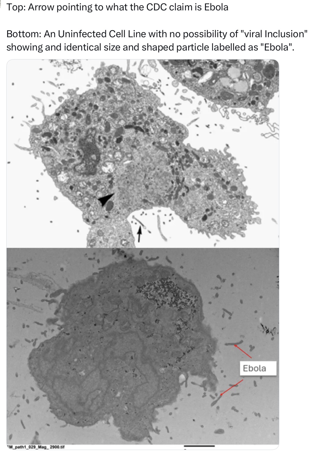 'Ebola virus' is just dead cell debris
